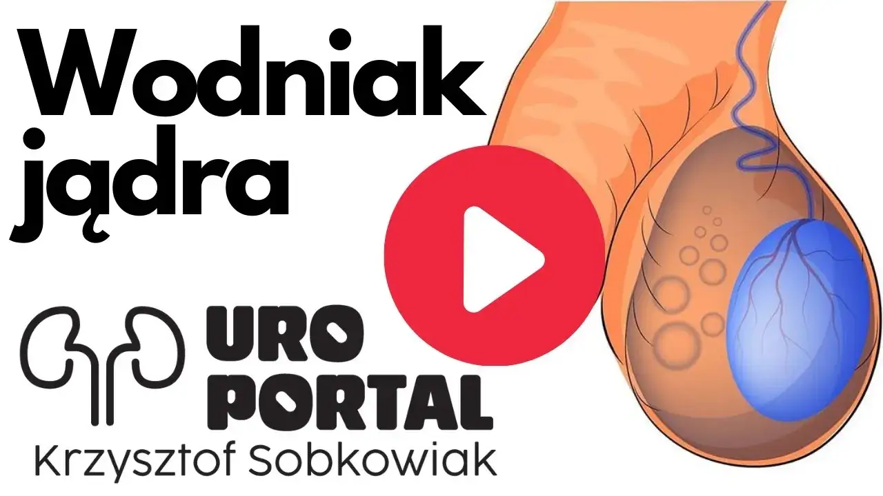Zdjęcie Wodniak jądra u dziecka – jak wygląda, objawy i kiedy zgłosić się do lekarza